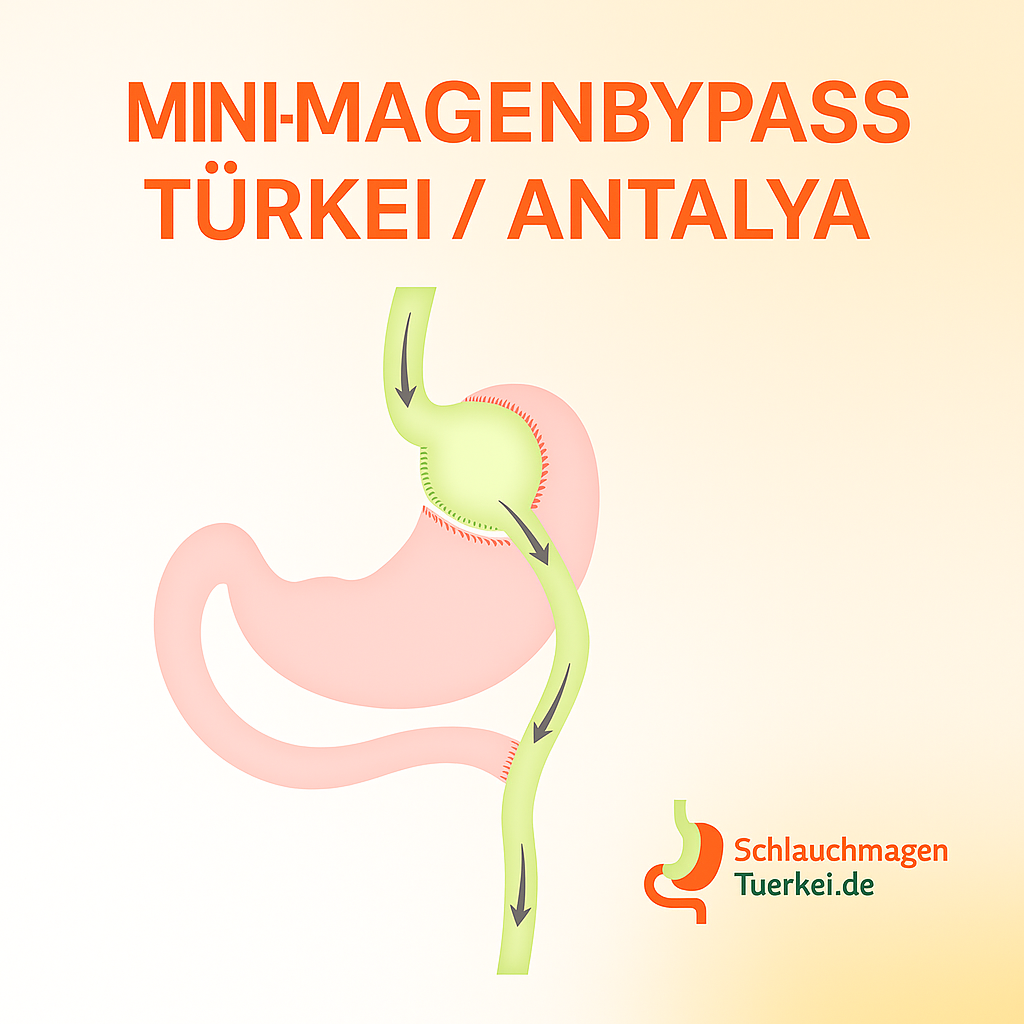 Mini Magenbypass Türkei / Antalya